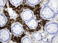TYMP Monoclonal Antibody (OTI5B11), TrueMAB , OriGene 100 &mu;L; Unconjugated:Antibodies,