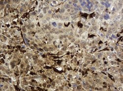 TYMP Monoclonal Antibody (OTI5B11), TrueMAB , OriGene 100 &mu;L; Unconjugated:Antibodies,