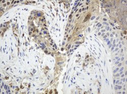 TYMP Mouse anti-Human, Clone: OTI7B4, lyophilized, TrueMAB 100 &mu;g; Unconjugated:Antibodies,