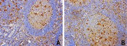 TYMP Mouse anti-Human, Clone: UMAB97, lyophilized, UltraMAB 100 &mu;g | Buy Online | OriGene | Fisher Scientific