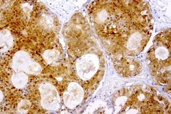 TYMP Mouse anti-Human, Clone: UMAB97, lyophilized, UltraMAB 100 &mu;g | Buy Online | OriGene | Fisher Scientific