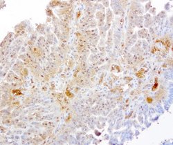 TYMP Mouse anti-Human, Clone: UMAB97, lyophilized, UltraMAB 100 &mu;g | Buy Online | OriGene | Fisher Scientific