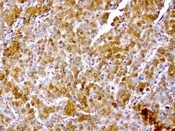 TYMP Mouse anti-Human, Clone: UMAB97, lyophilized, UltraMAB 100 &mu;g | Buy Online | OriGene | Fisher Scientific
