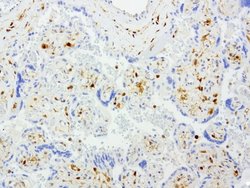 TYMP Mouse anti-Human, Clone: UMAB97, lyophilized, UltraMAB 100 &mu;g | Buy Online | OriGene | Fisher Scientific