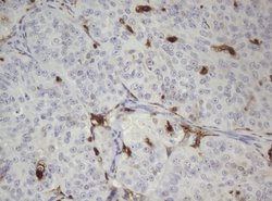 TYMP Mouse anti-Human, Clone: UMAB97, lyophilized, UltraMAB 100 &mu;g | Buy Online | OriGene | Fisher Scientific