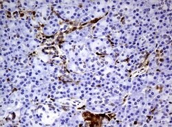 TYMP Mouse anti-Human, Clone: UMAB97, lyophilized, UltraMAB 100 &mu;g | Buy Online | OriGene | Fisher Scientific