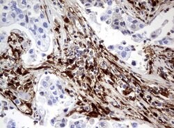 TYMP Mouse anti-Human, Clone: UMAB97, lyophilized, UltraMAB 100 &mu;g | Buy Online | OriGene | Fisher Scientific