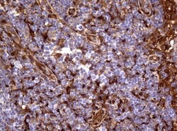 TYMP Mouse anti-Human, Clone: UMAB97, lyophilized, UltraMAB 100 &mu;g | Buy Online | OriGene | Fisher Scientific