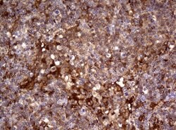 TYMP Mouse anti-Human, Clone: UMAB97, lyophilized, UltraMAB 100 &mu;g | Buy Online | OriGene | Fisher Scientific
