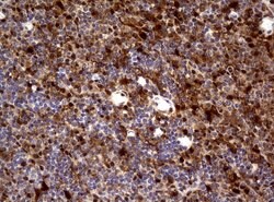 TYMP Mouse anti-Human, Clone: UMAB97, lyophilized, UltraMAB 100 &mu;g | Buy Online | OriGene | Fisher Scientific
