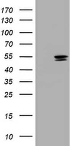TYMP Mouse anti-Human, Clone: OTI1E7, liquid, TrueMAB 100 &mu;L; Unconjugated:Antibodies,