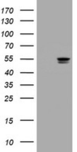 TYMP Mouse anti-Human, Clone: OTI1H7, lyophilized, TrueMAB 100 &mu;g; Unconjugated:Antibodies,