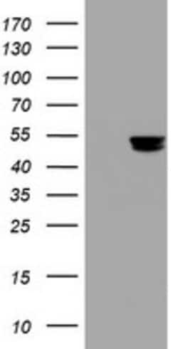 TYMP Mouse anti-Human, Clone: OTI7A6, lyophilized, TrueMAB 100 &mu;g; Unconjugated:Antibodies,