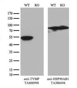 TYMP Mouse anti-Human, Clone: OTI7A6, lyophilized, TrueMAB 100 &mu;g; Unconjugated:Antibodies,