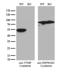 TYMP Monoclonal Antibody (OTI7A6), TrueMAB , OriGene 30 &mu;L; Unconjugated:Antibodies,