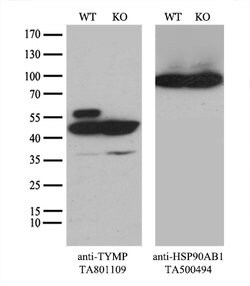 TYMP Mouse anti-Human, Clone: OTI7B4, lyophilized, TrueMAB 100 &mu;g; Unconjugated:Antibodies,