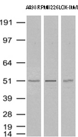 TYMP Mouse anti-Human, Clone: UMAB97, lyophilized, UltraMAB 100 &mu;g | Buy Online | OriGene | Fisher Scientific