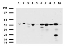 TYMP Mouse anti-Human, Clone: UMAB97, lyophilized, UltraMAB 100 &mu;g | Buy Online | OriGene | Fisher Scientific
