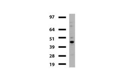 TYMP Mouse anti-Human, Clone: UMAB97, lyophilized, UltraMAB 100 &mu;g | Buy Online | OriGene | Fisher Scientific