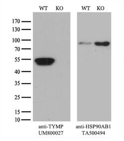 TYMP Mouse anti-Human, Clone: UMAB97, lyophilized, UltraMAB 100 &mu;g | Buy Online | OriGene | Fisher Scientific