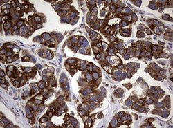 TYMS Monoclonal Antibody (OTI10F12), TrueMAB , OriGene 100 &mu;L; Unconjugated:Antibodies,