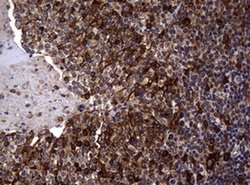 TYMS Monoclonal Antibody (OTI10F12), TrueMAB , OriGene 100 &mu;L; Unconjugated:Antibodies,