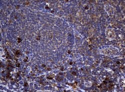 TYMS Monoclonal Antibody (OTI10F12), TrueMAB , OriGene 100 &mu;L; Unconjugated:Antibodies,