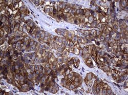 TYMS Monoclonal Antibody (OTI10F12), TrueMAB , OriGene 100 &mu;L; Unconjugated:Antibodies,