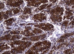 TYMS Monoclonal Antibody (OTI10F12), TrueMAB , OriGene 100 &mu;L; Unconjugated:Antibodies,