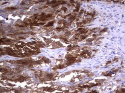TYMS Monoclonal Antibody (OTI5H8), TrueMAB , OriGene 100 &mu;L; Unconjugated:Antibodies,