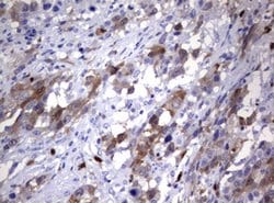 TYMS Mouse anti-Human, Clone: OTI1B1, lyophilized, TrueMAB 100 &mu;g; Unconjugated:Antibodies,
