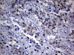 TYMS Monoclonal Antibody (OTI2C3), TrueMAB , OriGene 100 &mu;L; Unconjugated:Antibodies,