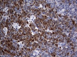 TYMS Monoclonal Antibody (OTI2C3), TrueMAB , OriGene 100 &mu;L; Unconjugated:Antibodies,