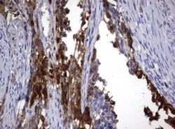 TYMS Monoclonal Antibody (OTI1A3), TrueMAB , OriGene 100 &mu;L; Unconjugated:Antibodies,