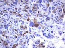 TYMS Monoclonal Antibody (OTI1A3), TrueMAB , OriGene 100 &mu;L; Unconjugated:Antibodies,
