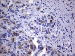 TYMS Monoclonal Antibody (OTI1A3), TrueMAB , OriGene 100 &mu;L; Unconjugated:Antibodies,