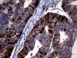 TYMS Mouse anti-Human, Clone: OTI1B2, lyophilized, TrueMAB 100 &mu;g; Unconjugated:Antibodies,