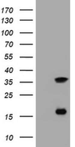 TYMS Monoclonal Antibody (OTI5H8), TrueMAB , OriGene:Antibodies:Primary