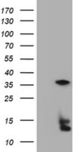 TYMS Mouse anti-Human, Clone: OTI1B1, lyophilized, TrueMAB 100 &mu;g; Unconjugated:Antibodies,