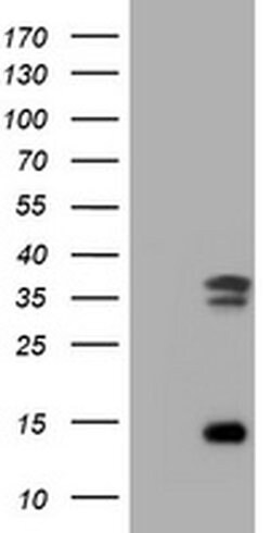 TYMS Monoclonal Antibody (OTI1A6), TrueMAB , OriGene:Antibodies:Primary