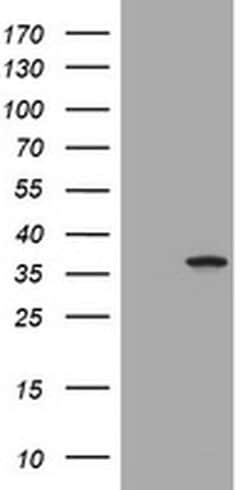 TYMS Monoclonal Antibody (OTI2C3), TrueMAB , OriGene 100 &mu;L; Unconjugated:Antibodies,