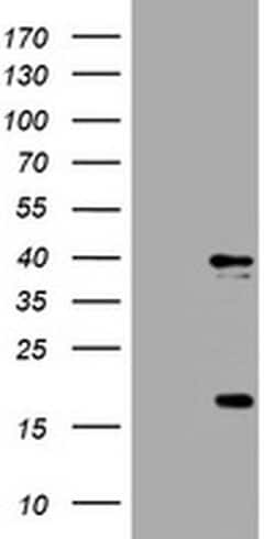 TYMS Monoclonal Antibody (OTI1A3), TrueMAB , OriGene 100 &mu;L; Unconjugated:Antibodies,