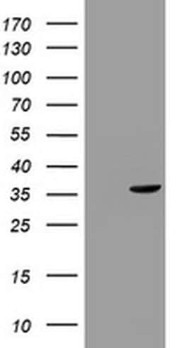 TYMS Monoclonal Antibody (OTI2C5), TrueMAB , OriGene:Antibodies:Primary
