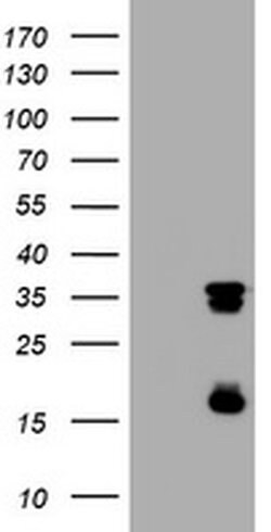TYMS Monoclonal Antibody (OTI4G10), TrueMAB , OriGene 100 &mu;L; Unconjugated:Antibodies,