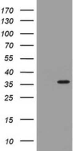 TYMS Mouse anti-Human, Clone: OTI1C4, lyophilized, TrueMAB 100 &mu;g; Unconjugated:Antibodies,