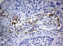 TYR Monoclonal Antibody (OTI1F3), TrueMAB , OriGene:Antibodies:Primary