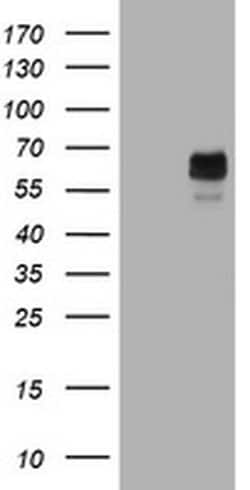 TYR Monoclonal Antibody (OTI1F3), TrueMAB , OriGene 100 &mu;L; Unconjugated:Antibodies,