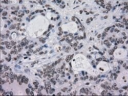 TYRO3 Mouse anti-Human, Clone: OTI5B4, liquid, TrueMAB 100 &mu;L; Unconjugated:Antibodies,