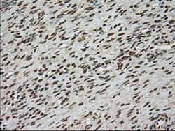 TYRO3 Mouse anti-Human, Clone: OTI4C8, liquid, TrueMAB 100 &mu;L; Unconjugated:Antibodies,