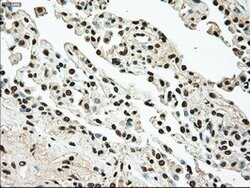 TYRO3 Mouse anti-Human, Clone: OTI4C8, lyophilized, TrueMAB 100 &mu;g | Buy Online | Origene Technologies | Fisher Scientific